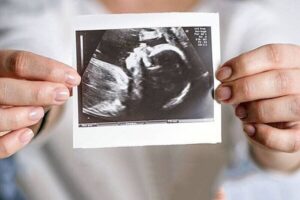 ویزیت رایگان مادران باردار ادامه دارد