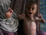 واقعیت تغییرناپذیر سلاح‌سازی گرسنگی توسط رژیم صهیونیستی